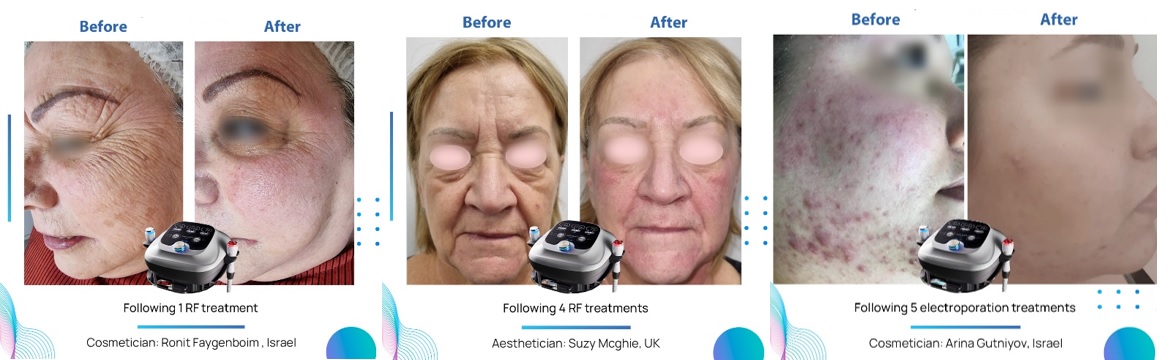 Безымянный