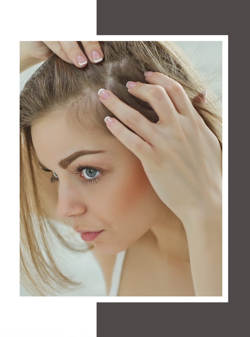 densite capillaire femme