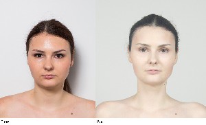 Лицевой фитнесс и Эстетические мануальные техники для лица и шеи