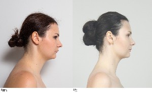 Лицевой фитнесс и Эстетические мануальные техники для лица и шеи