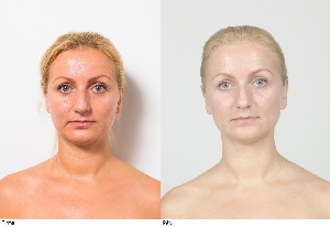 Лицевой фитнесс и Эстетические мануальные техники для лица и шеи