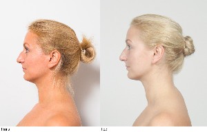 Лицевой фитнесс и Эстетические мануальные техники для лица и шеи