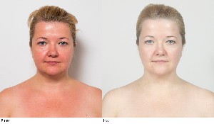 Лицевой фитнесс и Эстетические мануальные техники для лица и шеи