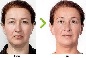 Лицевой фитнесс и Эстетические мануальные техники для лица и шеи