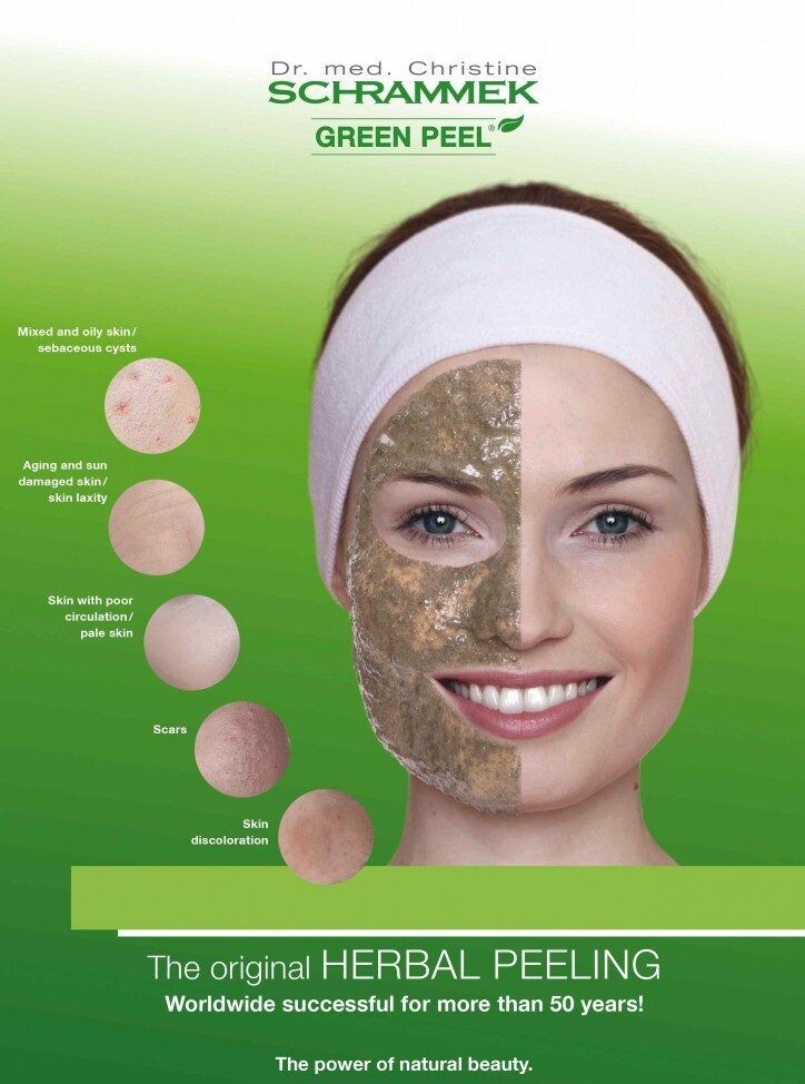 greenpeelimage-724x1024-1