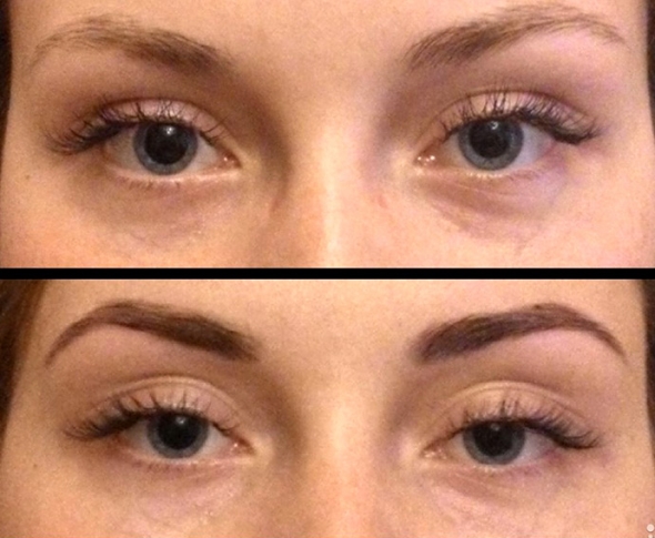 brovi-hnoy-do-posle1